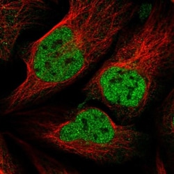 ZNF609 Antibody, Novus Biologicals 25 &mu;L, Unlabeled:Antibodies, Polyclonal